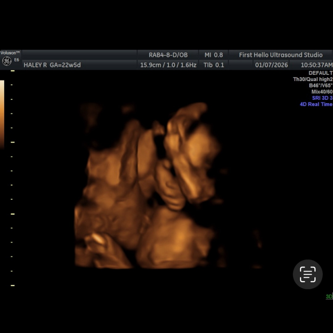 Photo shared by Haley for their Babylist baby registry.