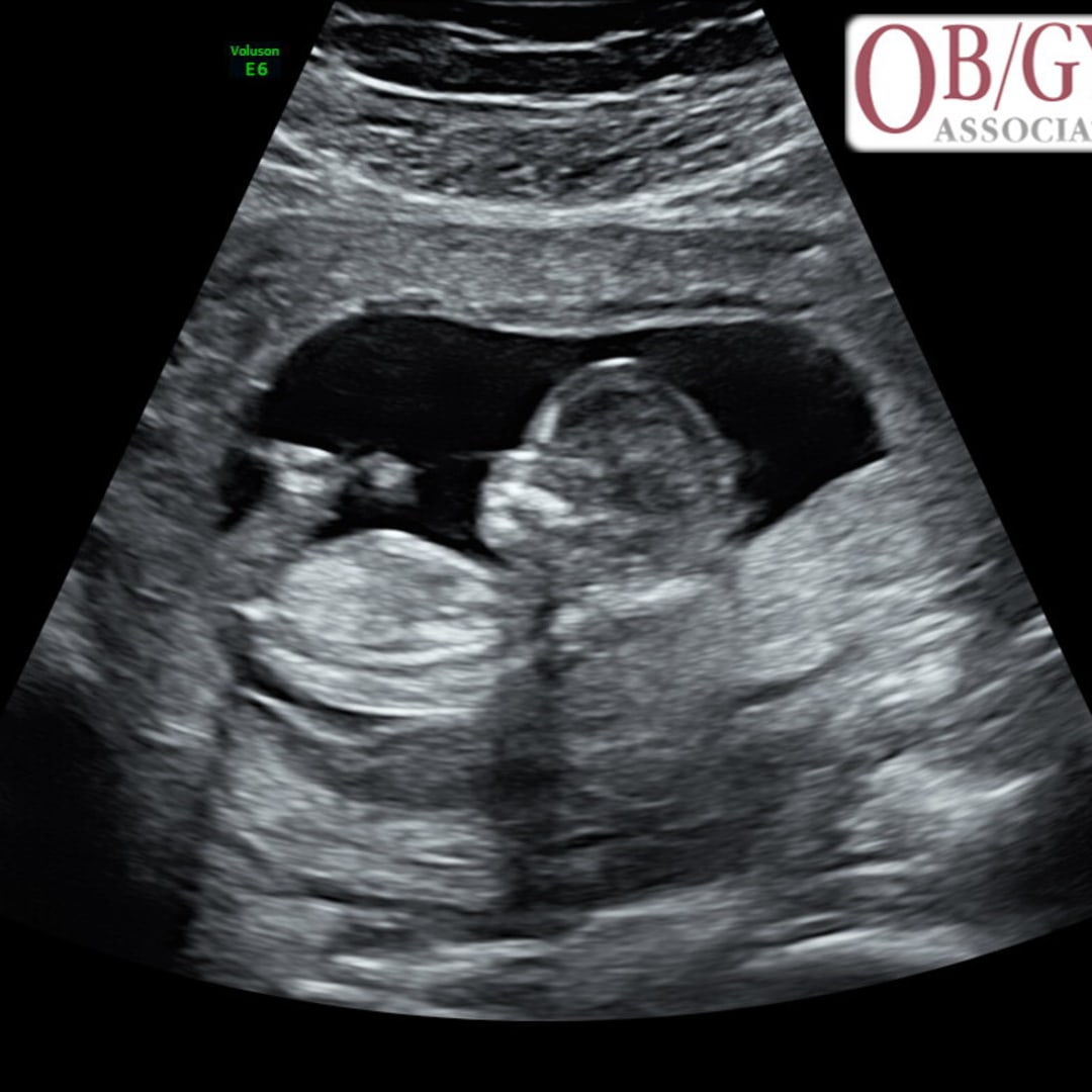 Photo shared by Jade for their Babylist baby registry.