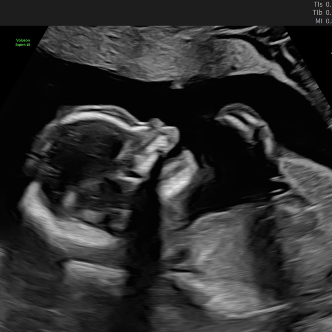 Photo shared by Kyri for their Babylist baby registry.