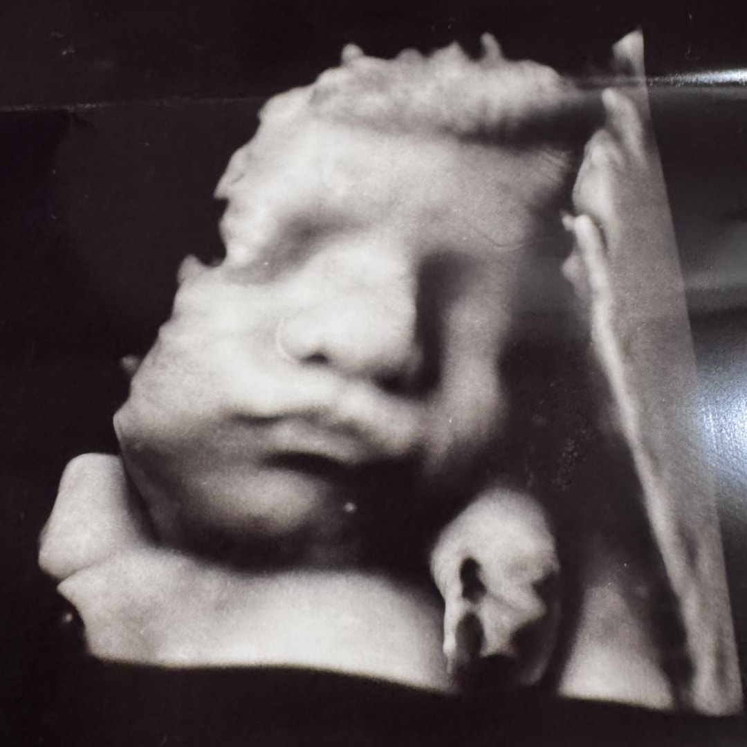 Photo shared by Shirin for their Babylist baby registry.