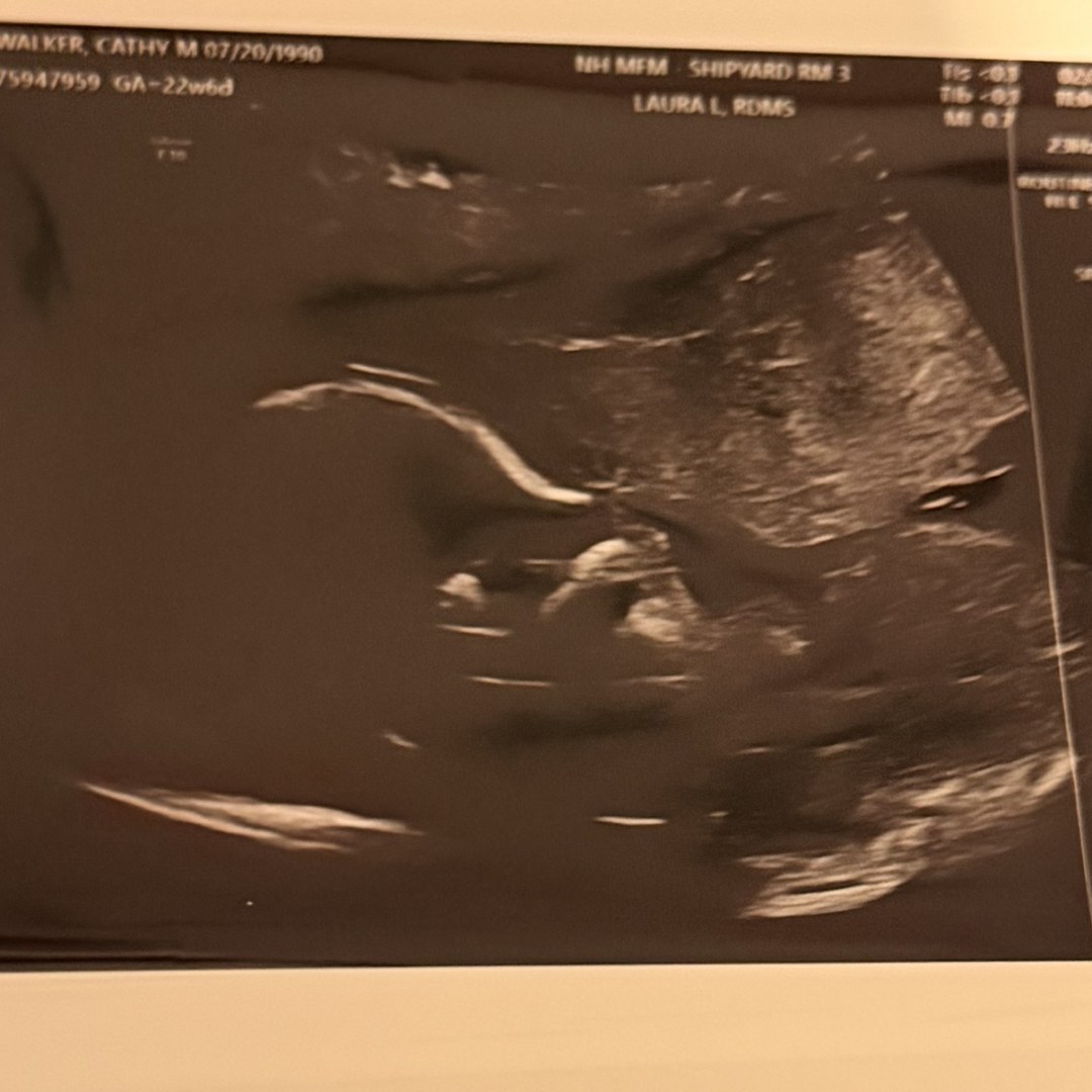 Photo shared by Morgan for their Babylist baby registry.