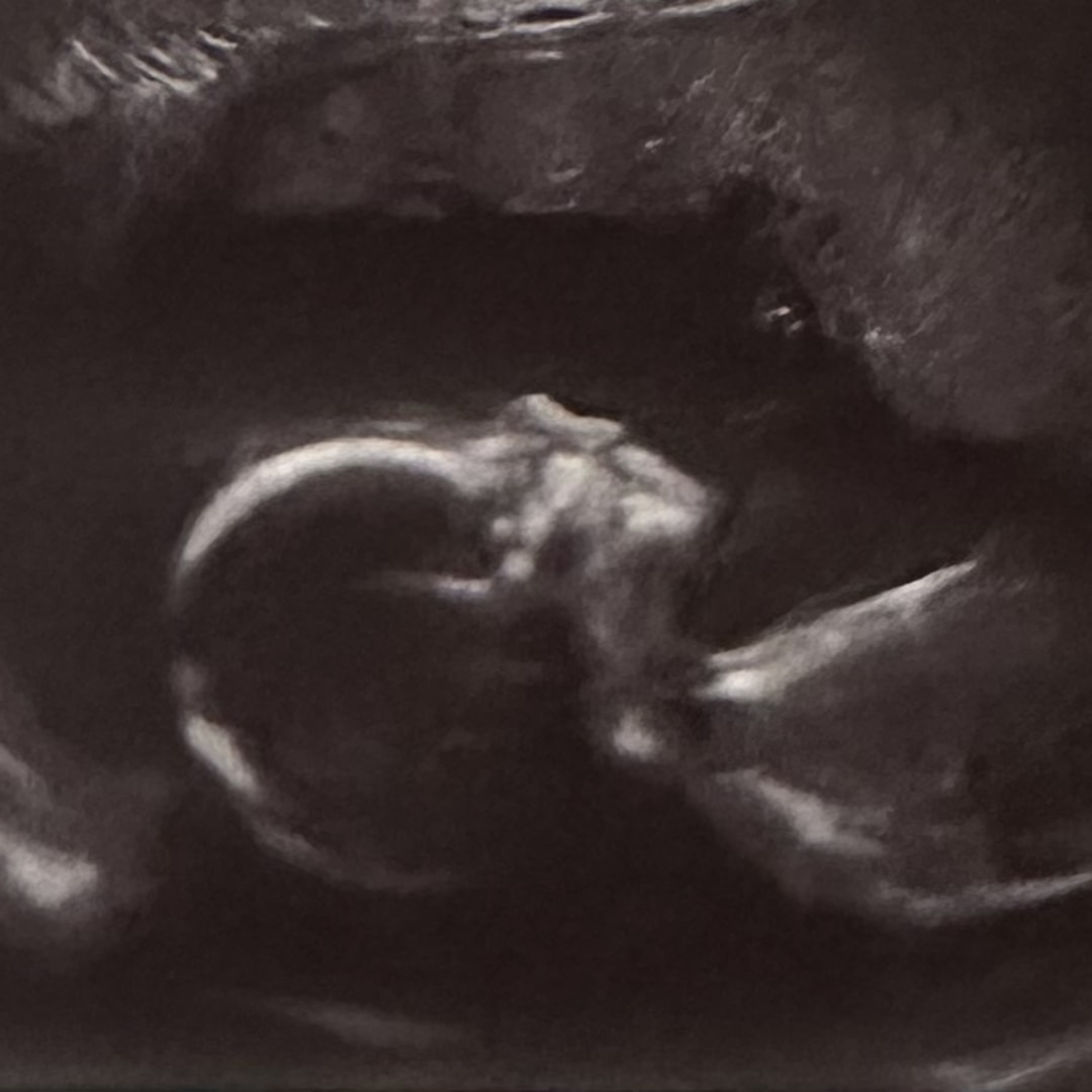 Photo shared by Ashlynn for their Babylist baby registry.