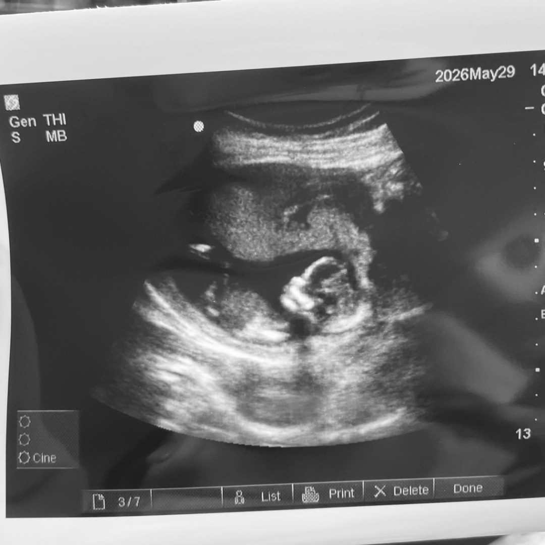 Photo shared by Iryna for their Babylist baby registry.
