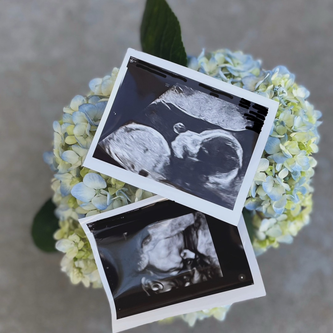 Photo shared by Brook for their Babylist baby registry.
