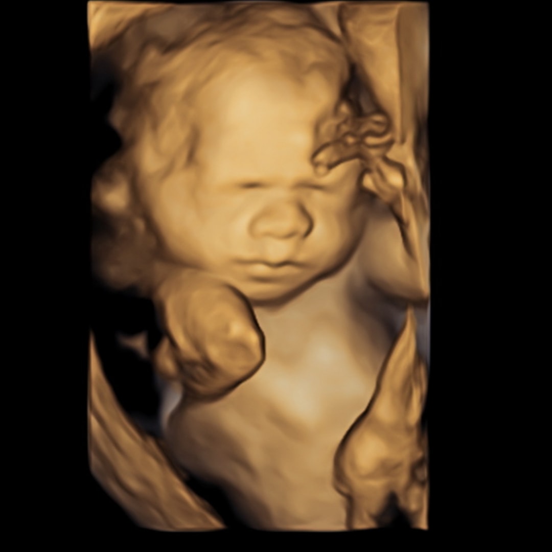 Photo shared by Brooke for their Babylist baby registry.