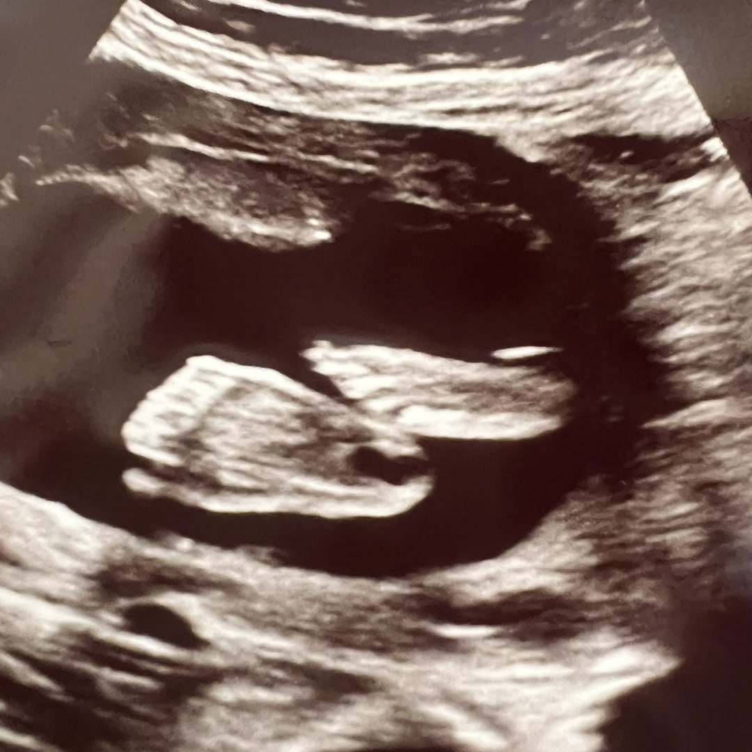 Photo shared by Rebekah for their Babylist baby registry.