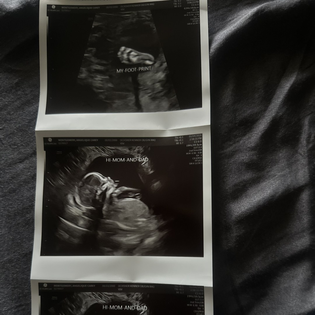 Photo shared by Angelique for their Babylist baby registry.