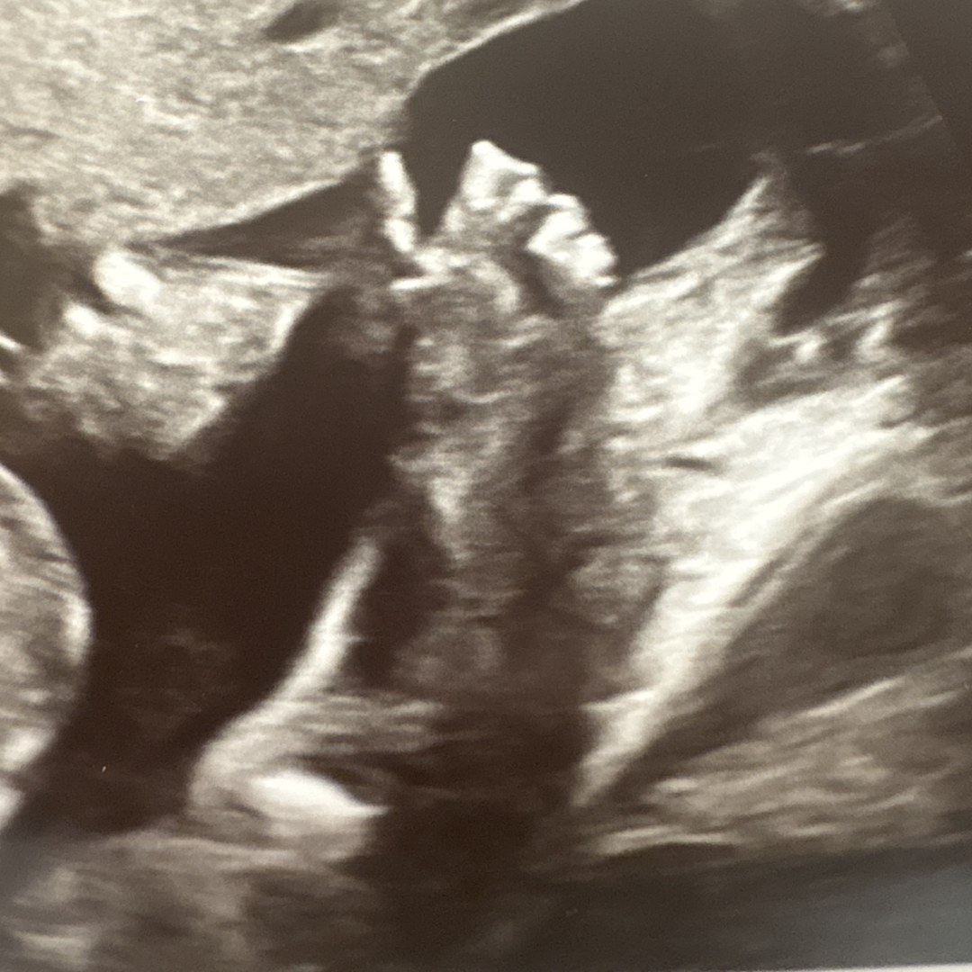 Photo shared by Emma for their Babylist baby registry.