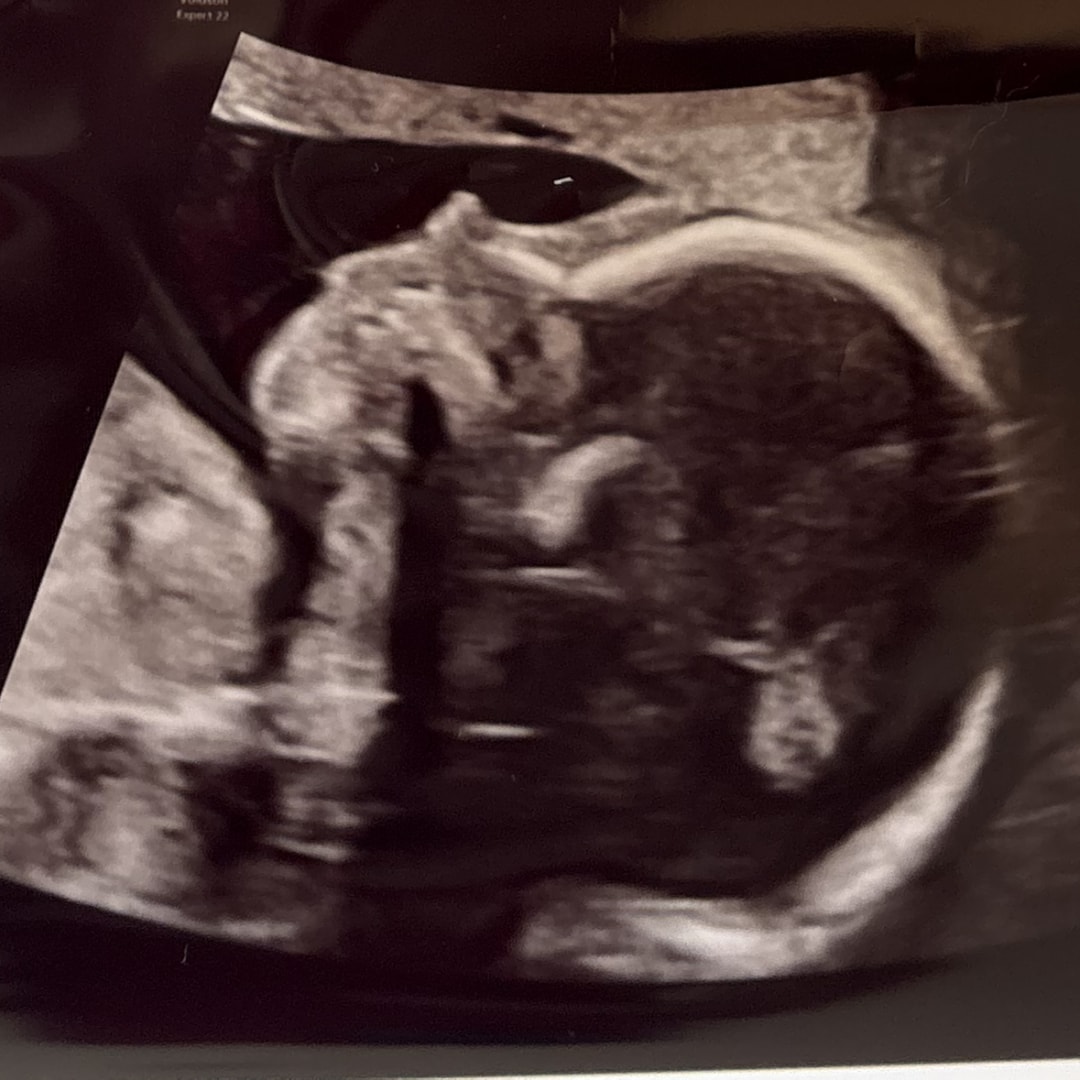 Photo shared by Emily for their Babylist baby registry.