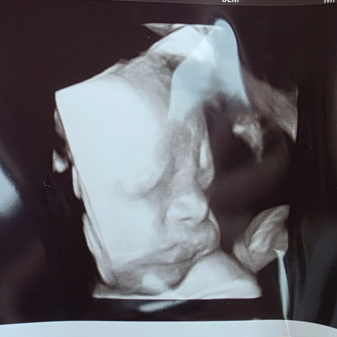 Photo shared by Margaret for their Babylist baby registry.