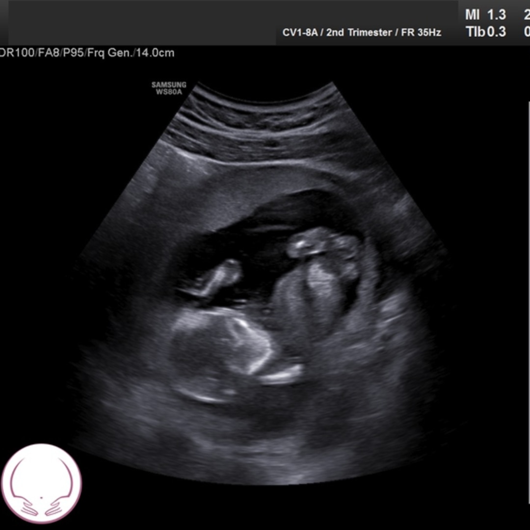 Photo shared by Madison for their Babylist baby registry.