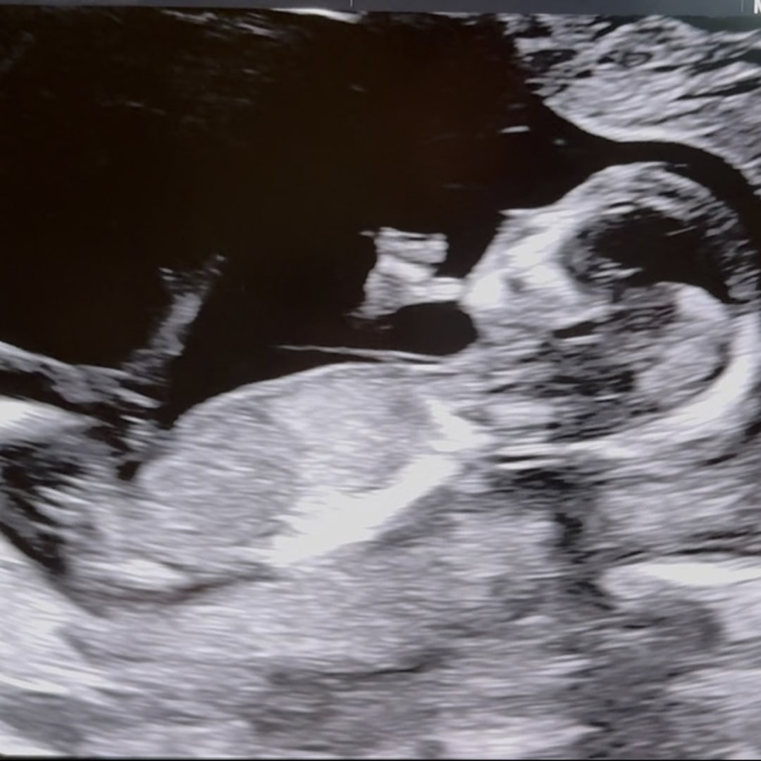 Photo shared by Erica for their Babylist baby registry.