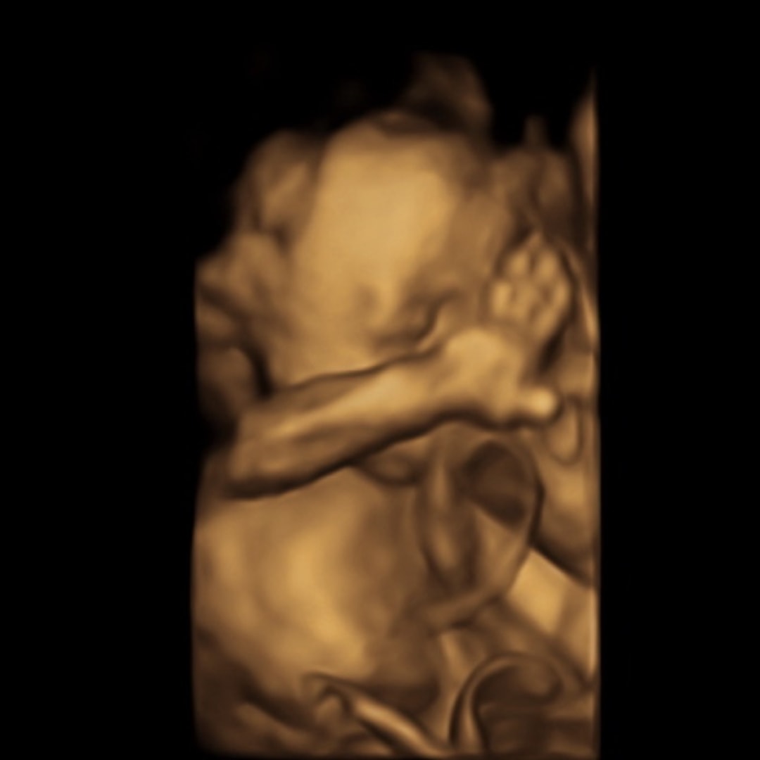 Photo shared by Martie for their Babylist baby registry.