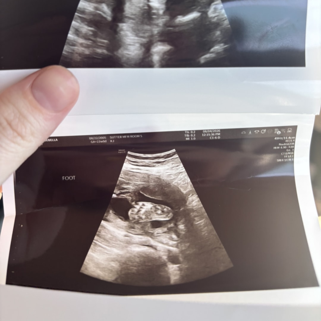 Photo shared by Isebella for their Babylist baby registry.