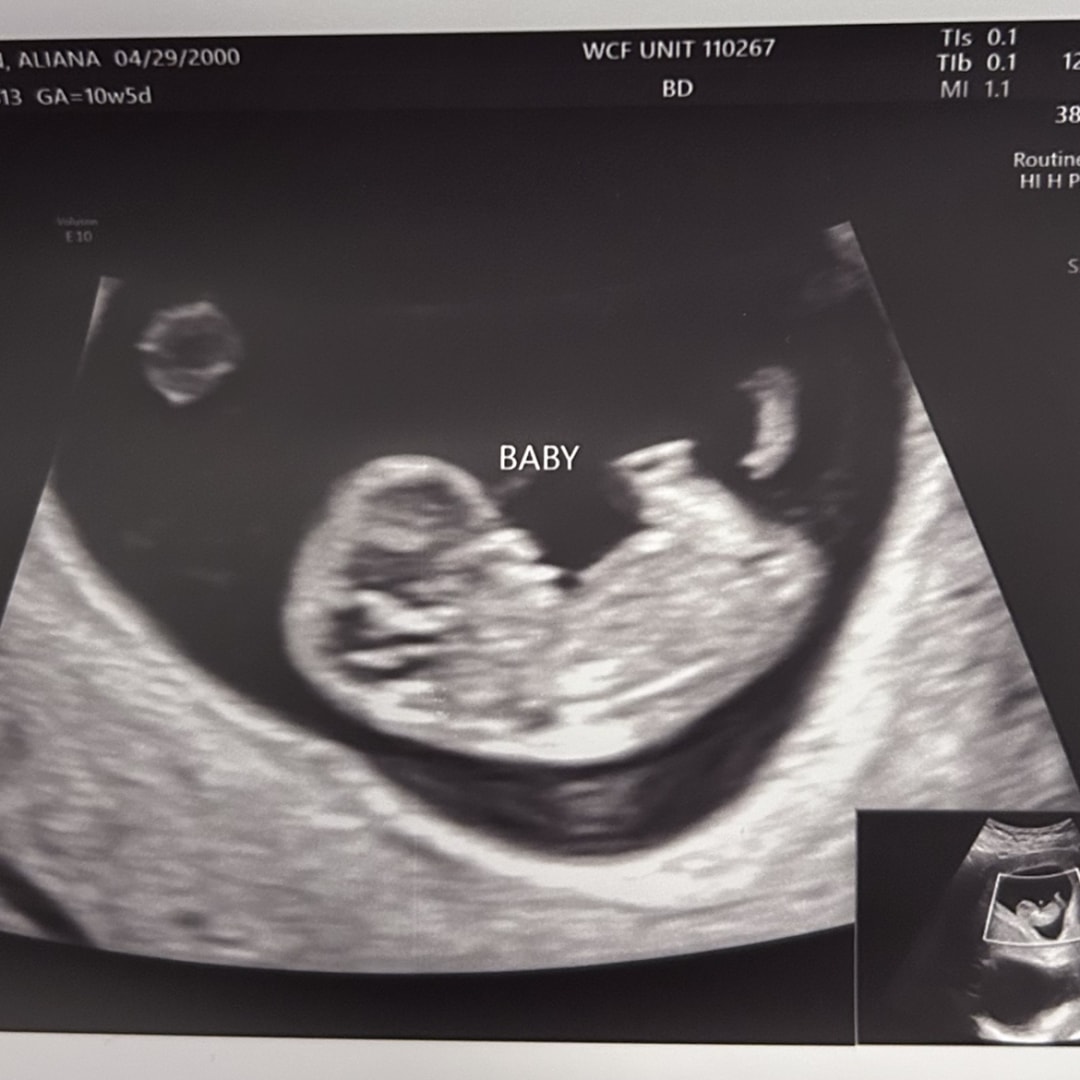 Photo shared by Aliana for their Babylist baby registry.