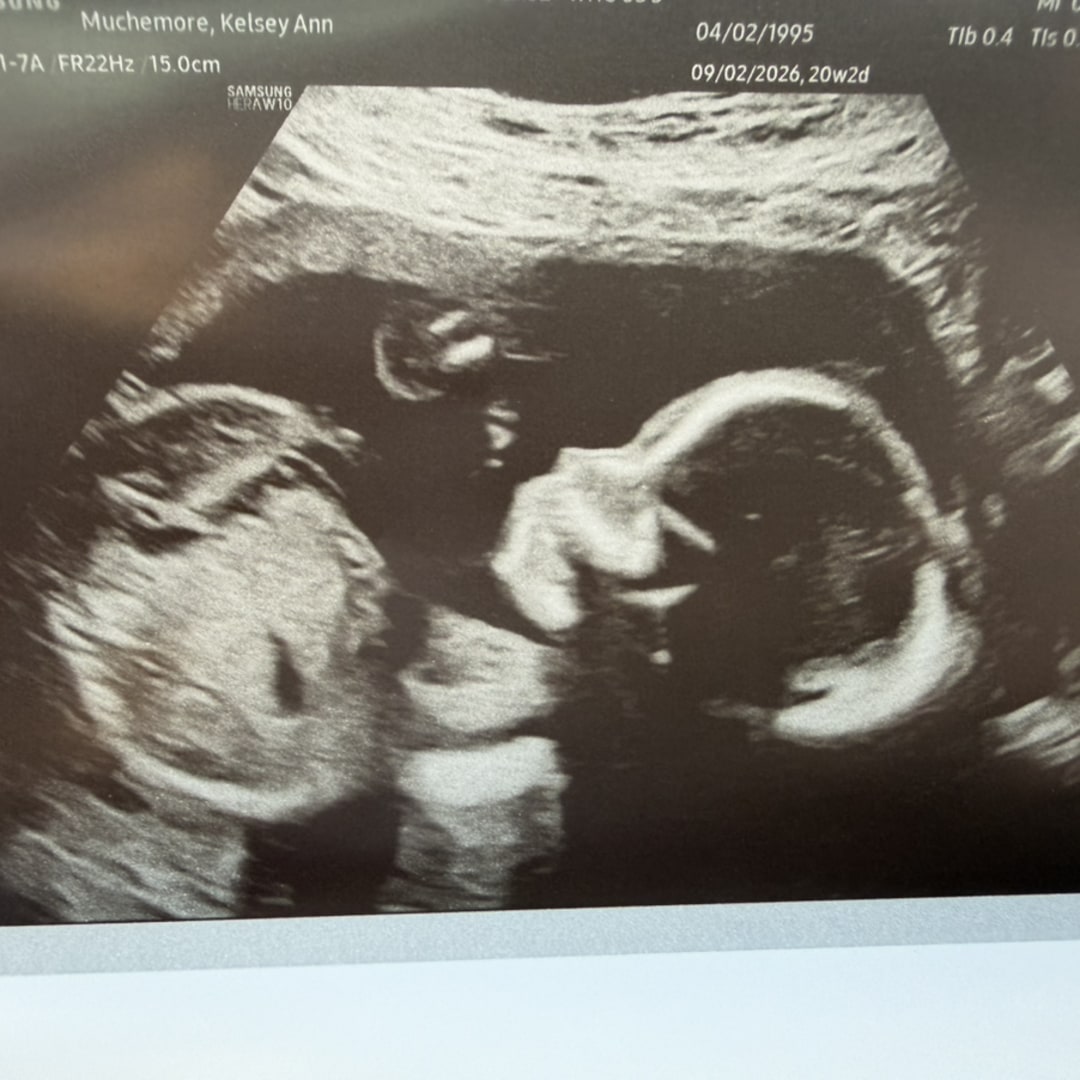 Photo shared by Kelsey for their Babylist baby registry.