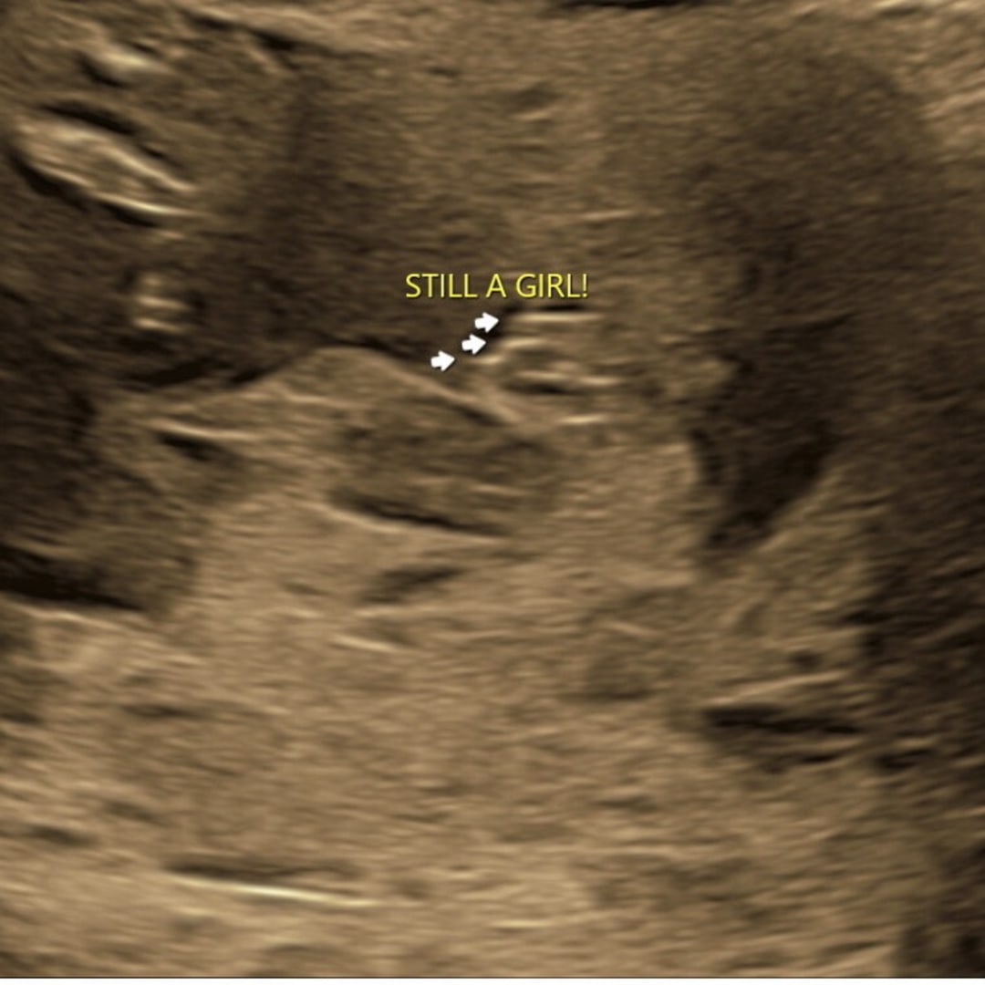 Photo shared by Cheyanne for their Babylist baby registry.