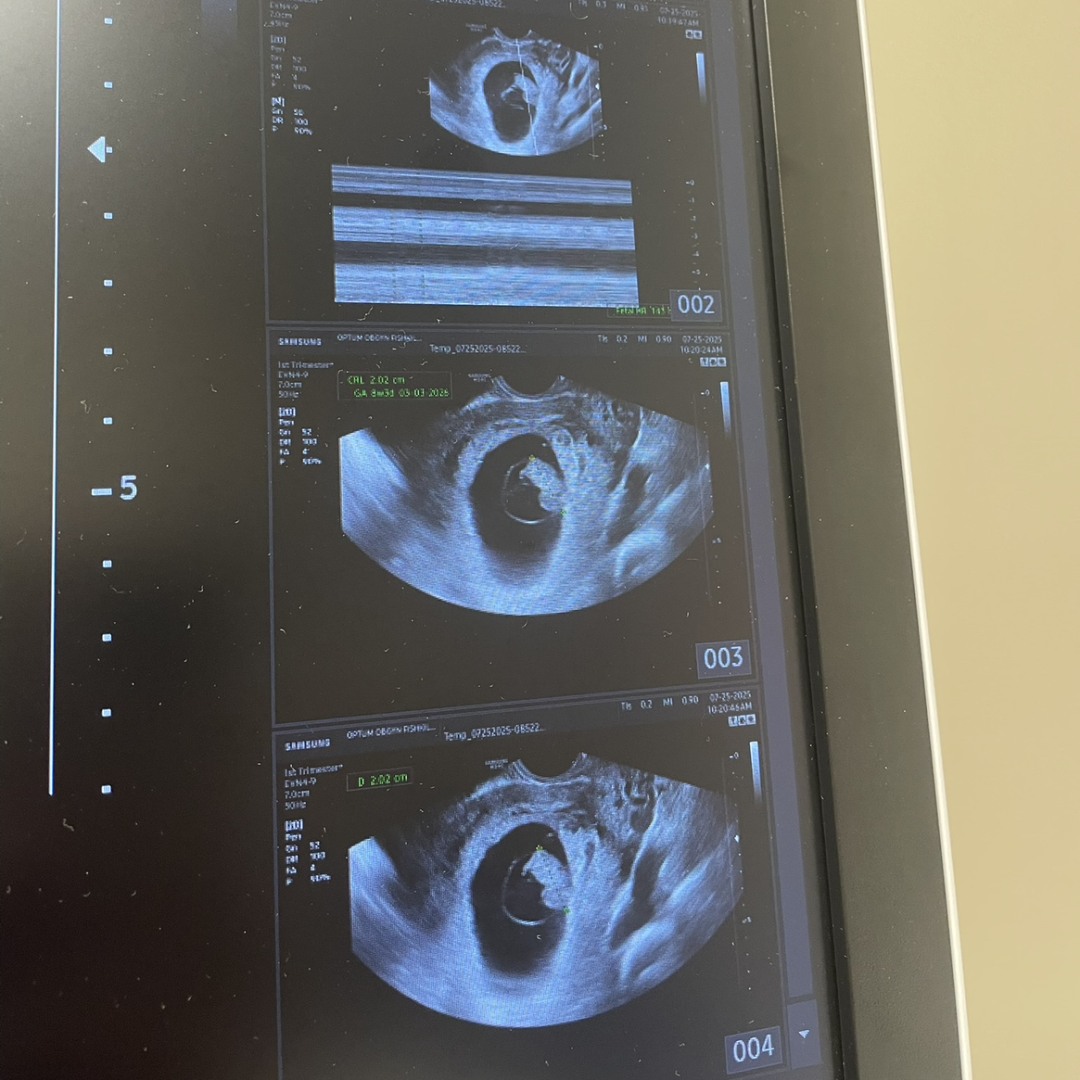 Photo shared by Casey for their Babylist baby registry.