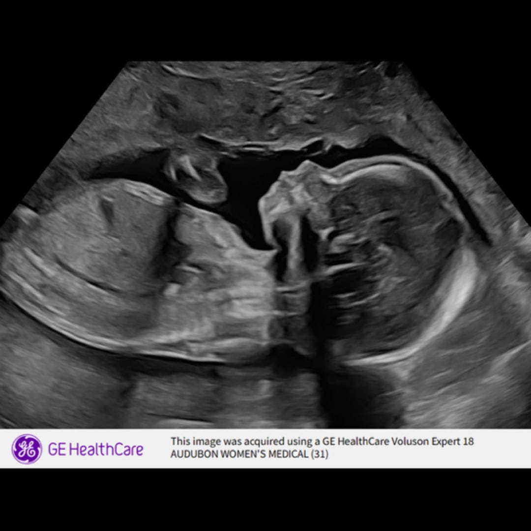 Photo shared by Diana for their Babylist baby registry.