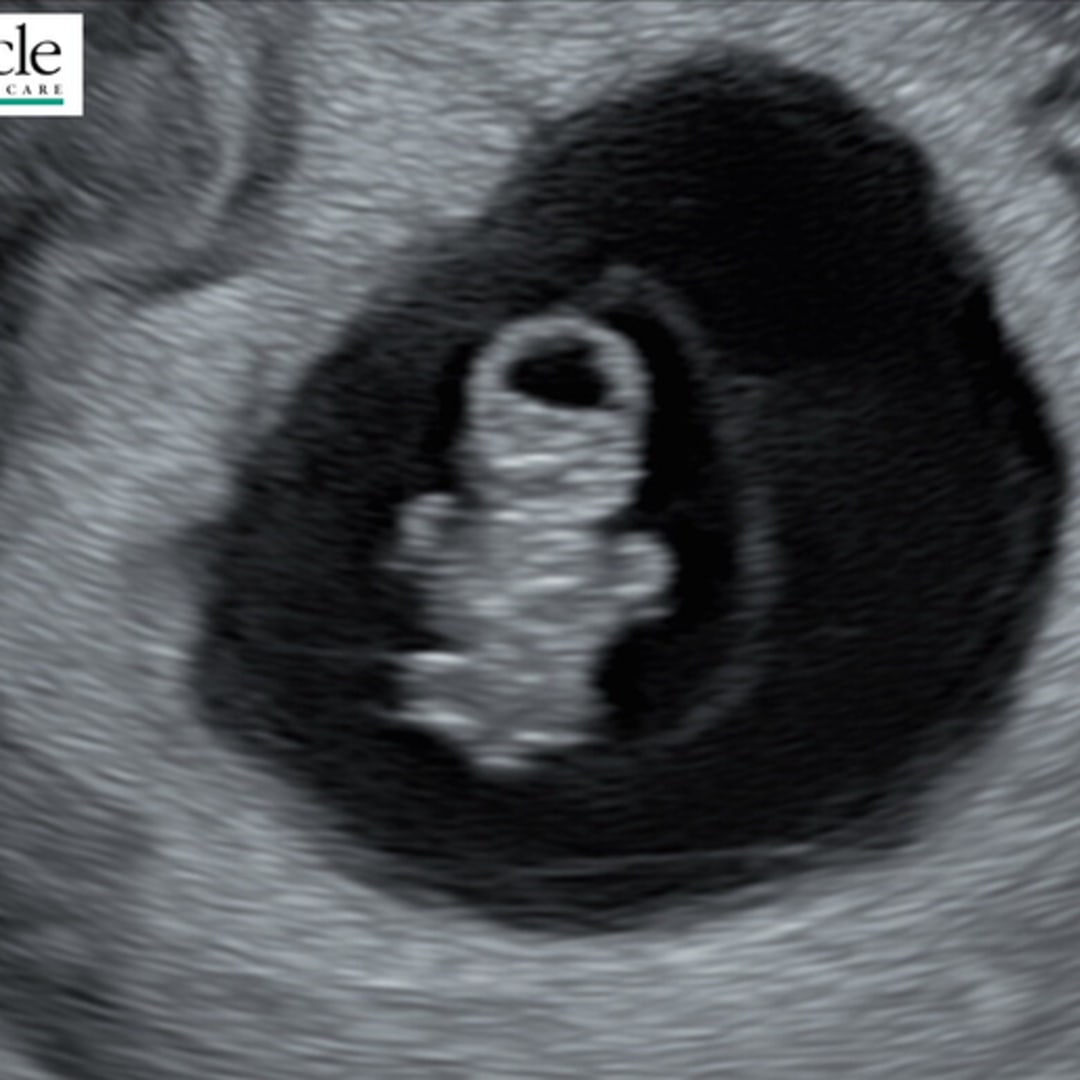 Photo shared by Riley for their Babylist baby registry.