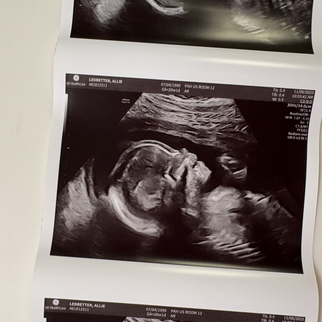 Photo shared by Allie for their Babylist baby registry.