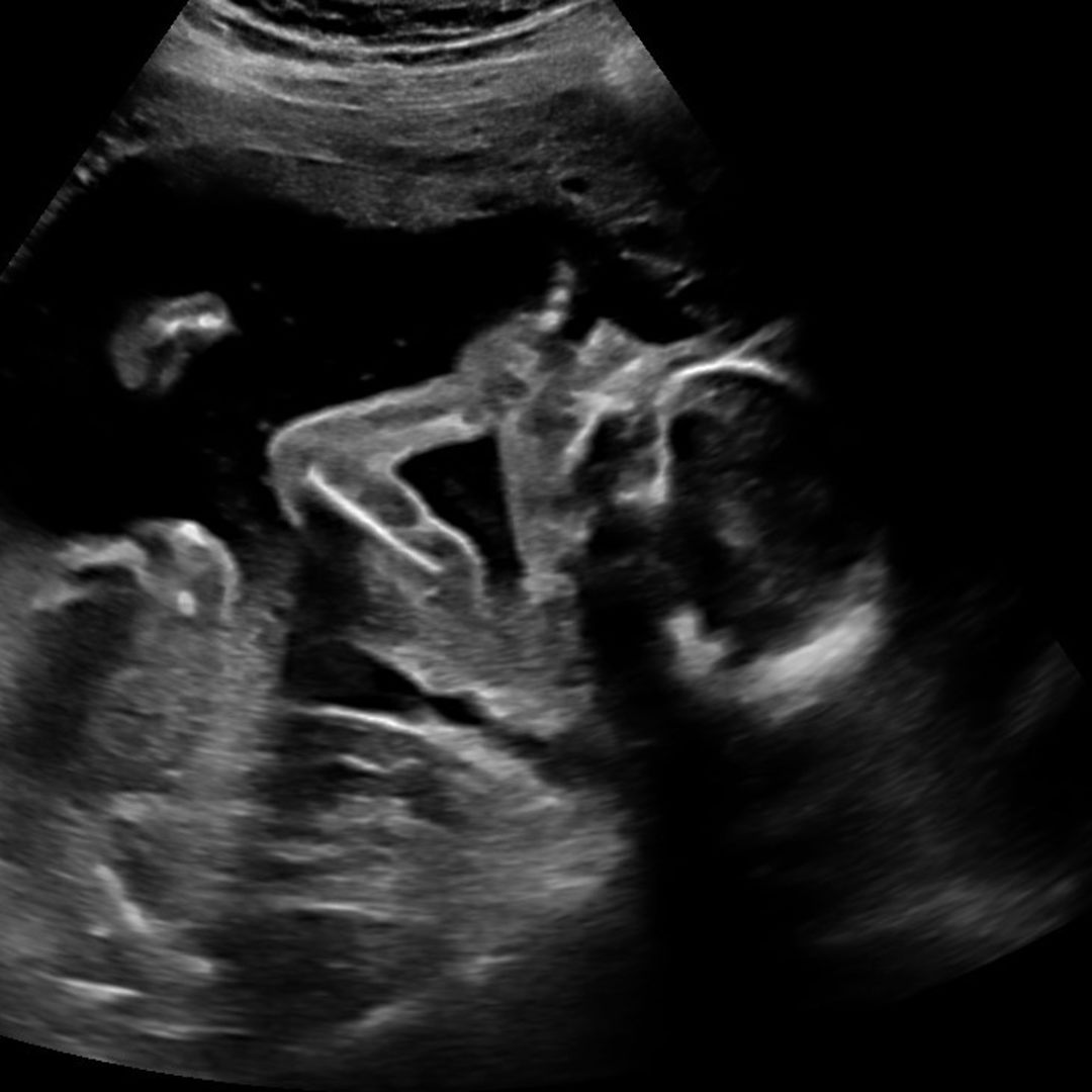 Photo shared by Grace for their Babylist baby registry.