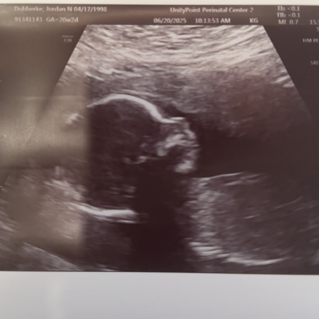 Photo shared by Jordan for their Babylist baby registry.