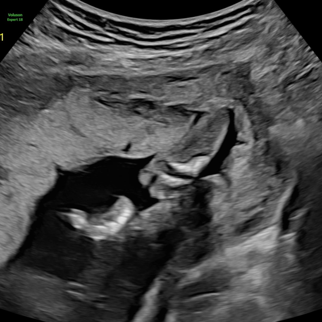 Photo shared by Grace for their Babylist baby registry.