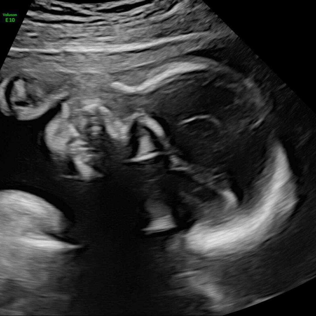 Photo shared by Cassidy for their Babylist baby registry.