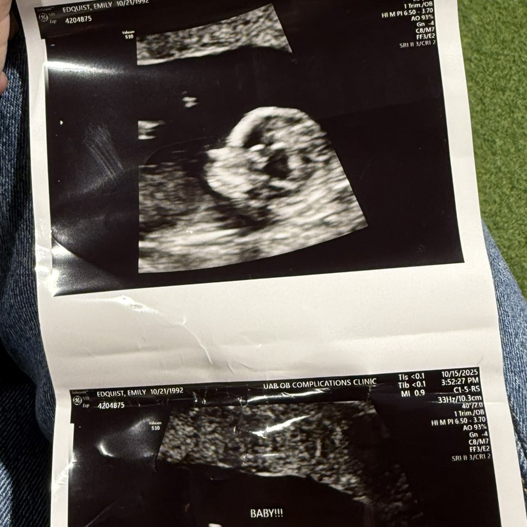 Photo shared by Emily for their Babylist baby registry.