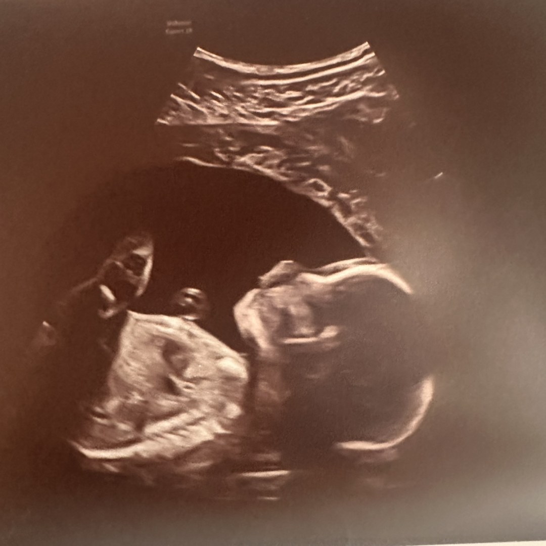 Photo shared by Kendall for their Babylist baby registry.