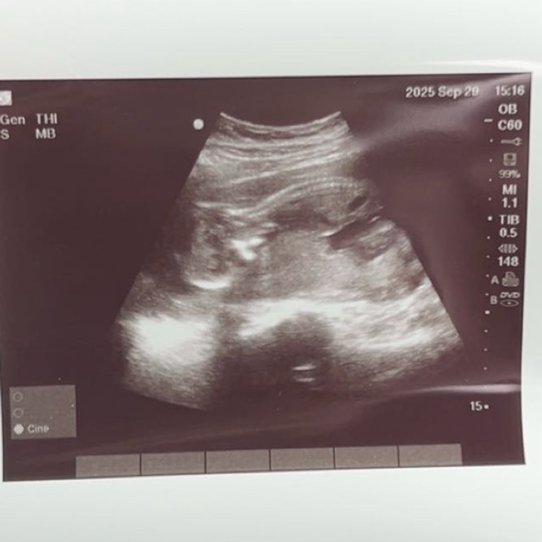 Photo shared by Karin for their Babylist baby registry.