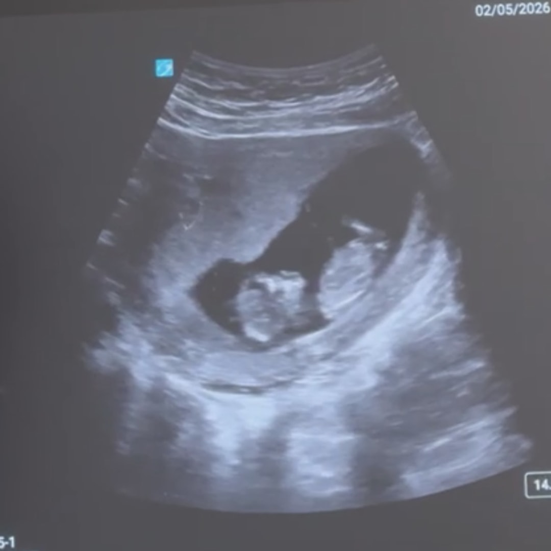 Photo shared by Savannah for their Babylist baby registry.