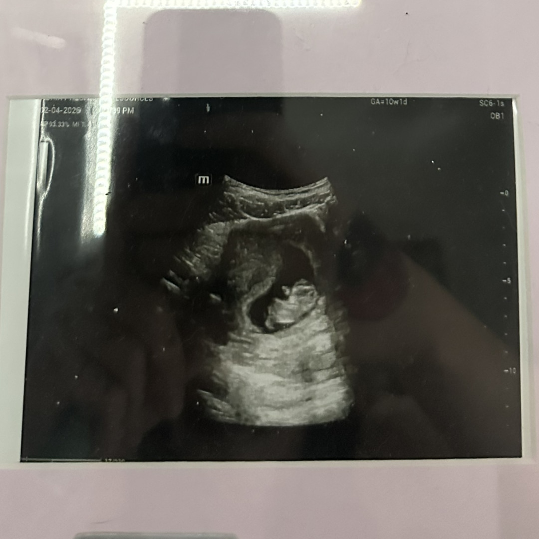 Photo shared by Gunner for their Babylist baby registry.