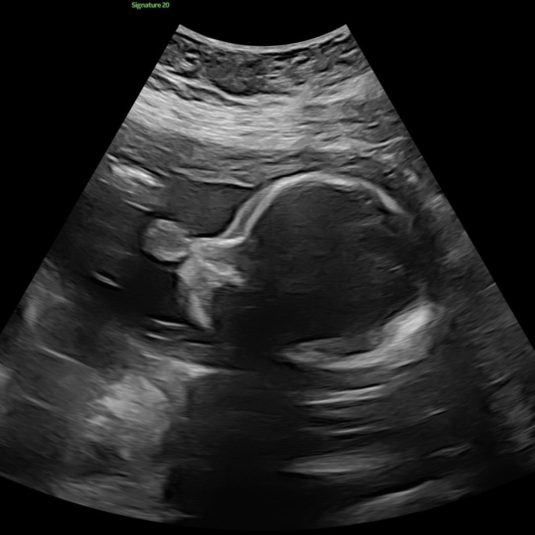 Photo shared by Hanna for their Babylist baby registry.