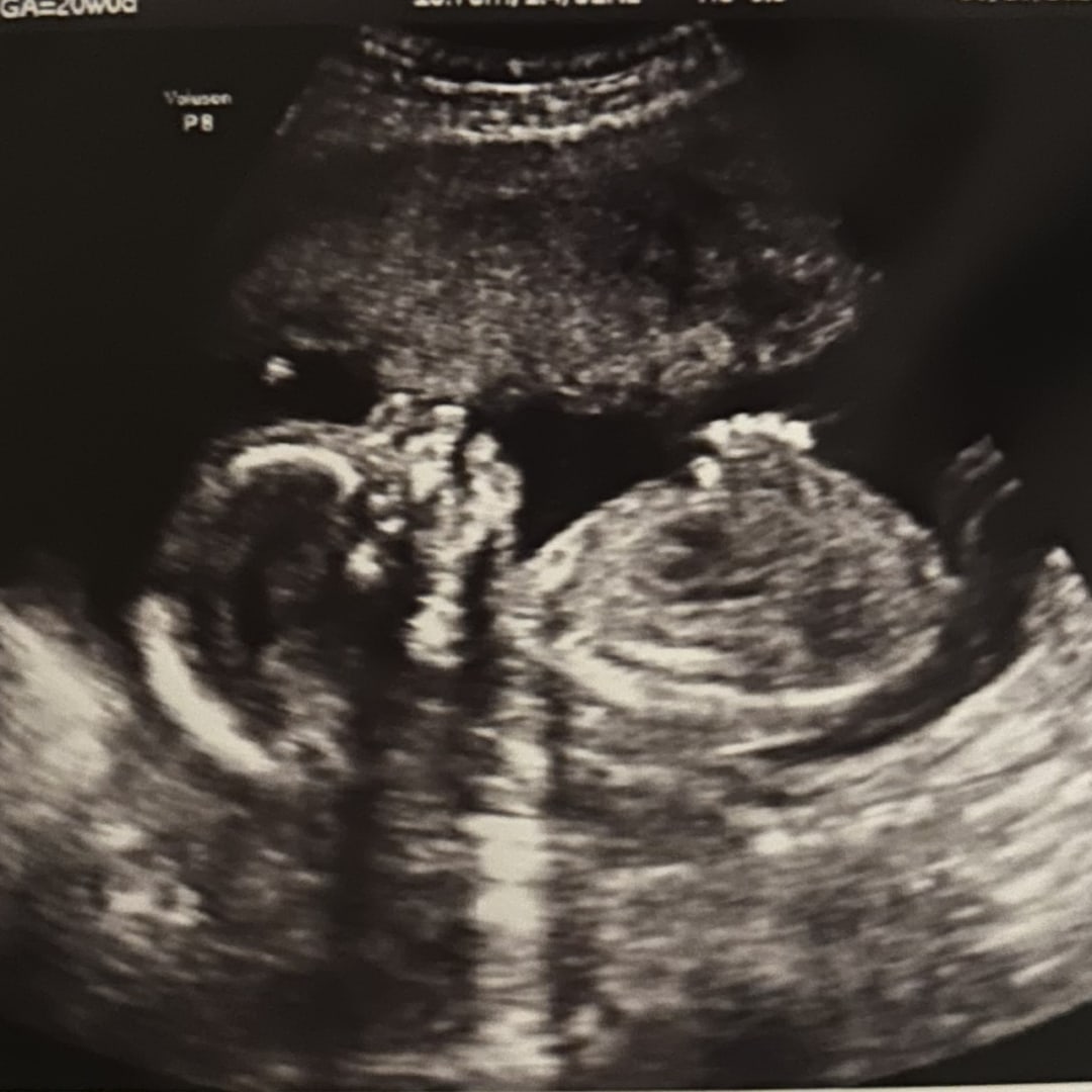 Photo shared by Lindsay for their Babylist baby registry.