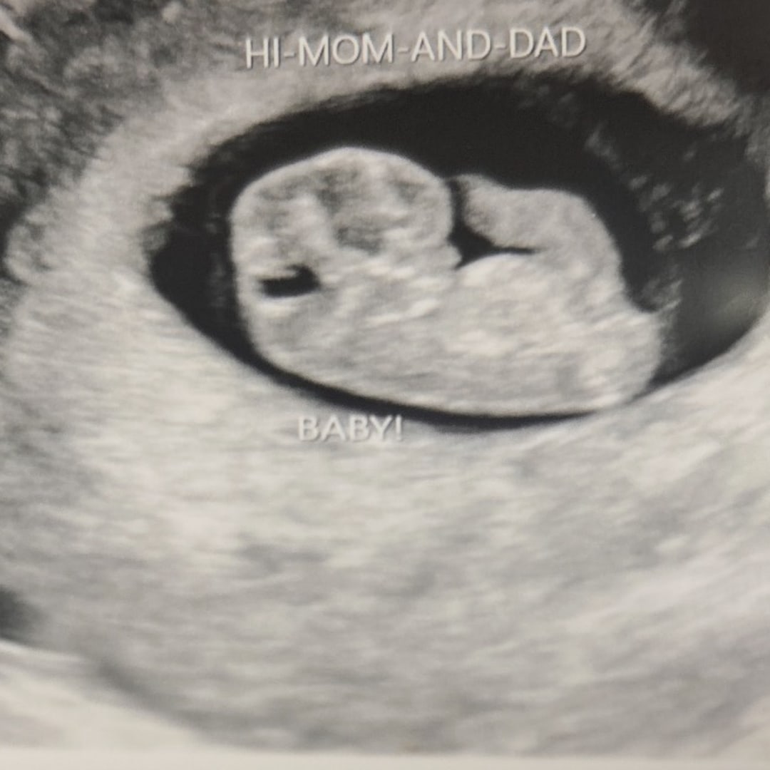 Photo shared by Kayla for their Babylist baby registry.