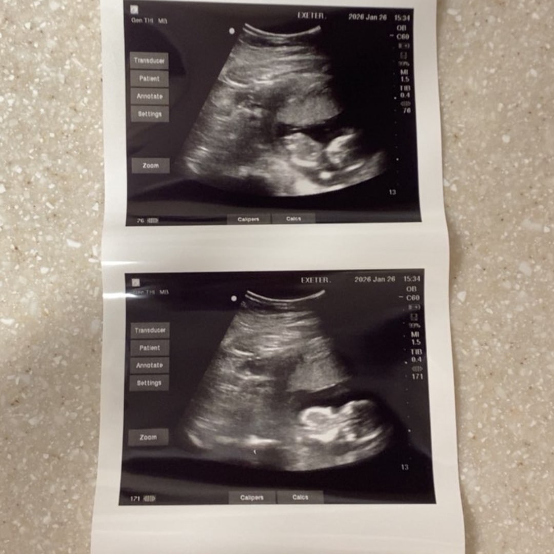 Photo shared by Miguel for their Babylist baby registry.