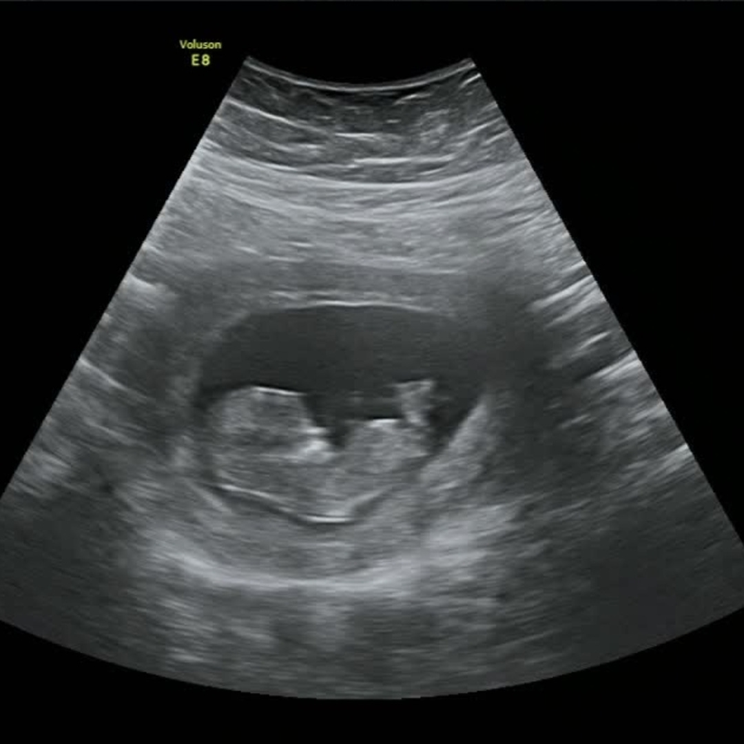 Photo shared by Grace for their Babylist baby registry.