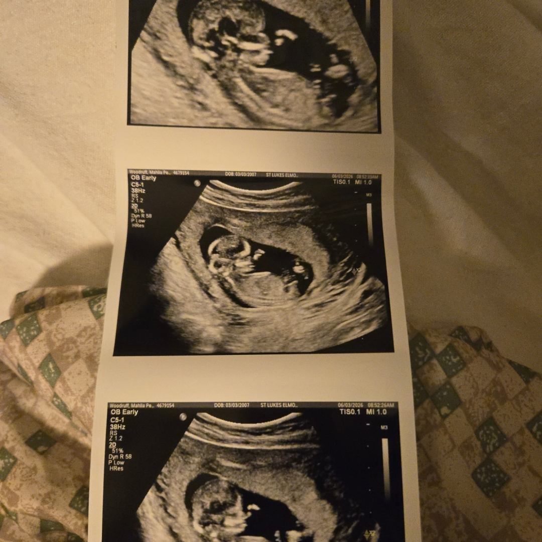 Photo shared by Mahlia for their Babylist baby registry.
