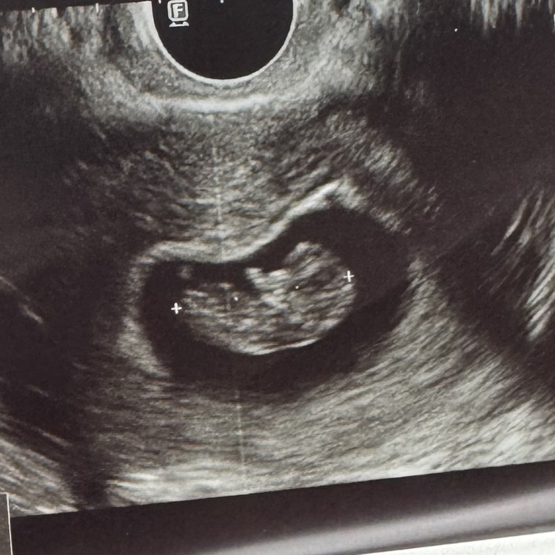 Photo shared by Nicole for their Babylist baby registry.