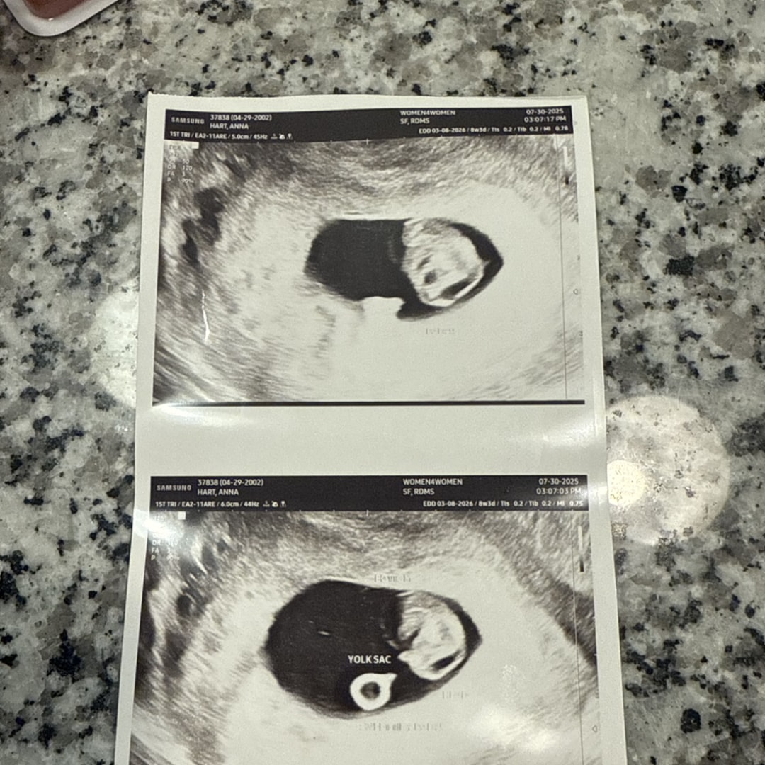 Photo shared by Anna for their Babylist baby registry.