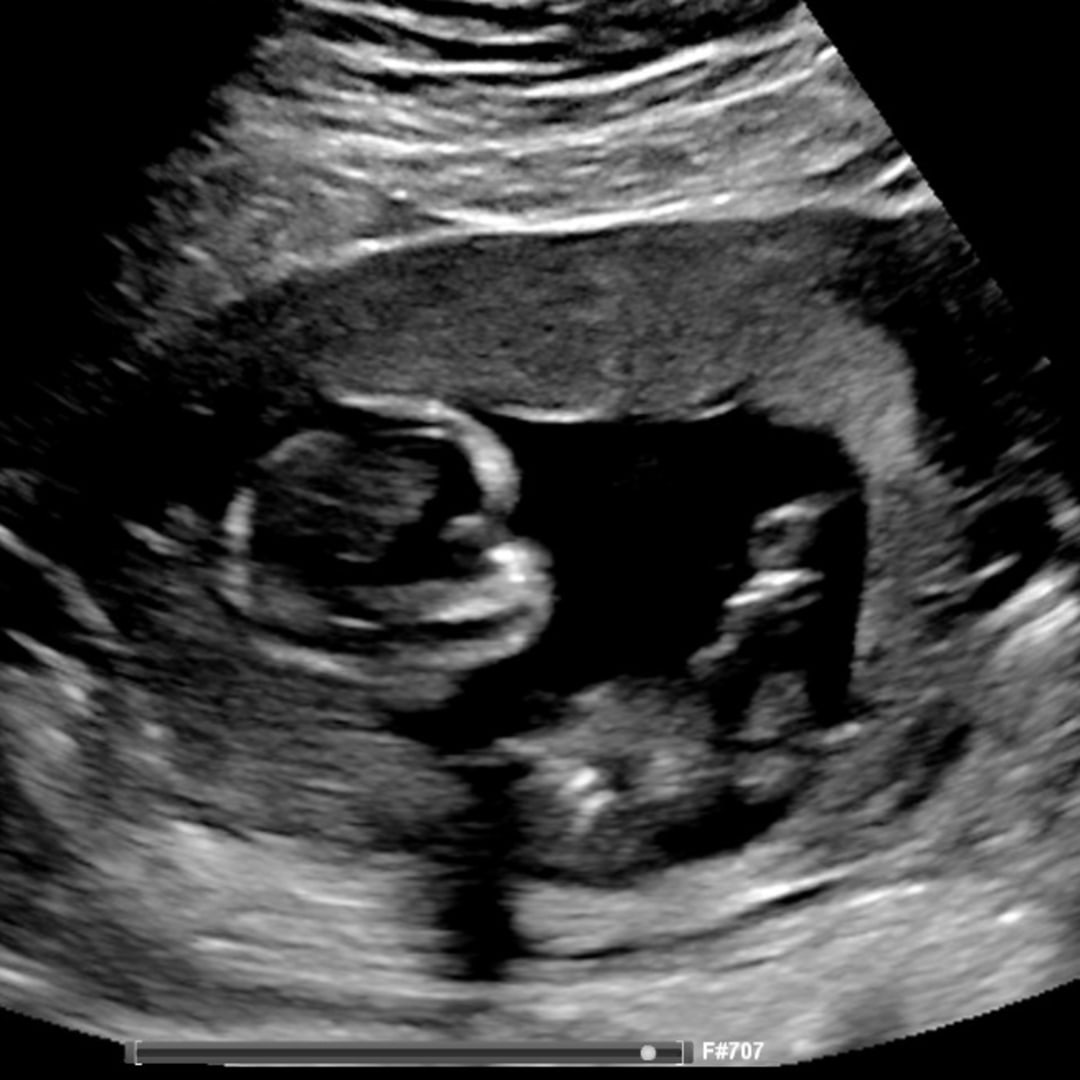 Photo shared by Sarah for their Babylist baby registry.