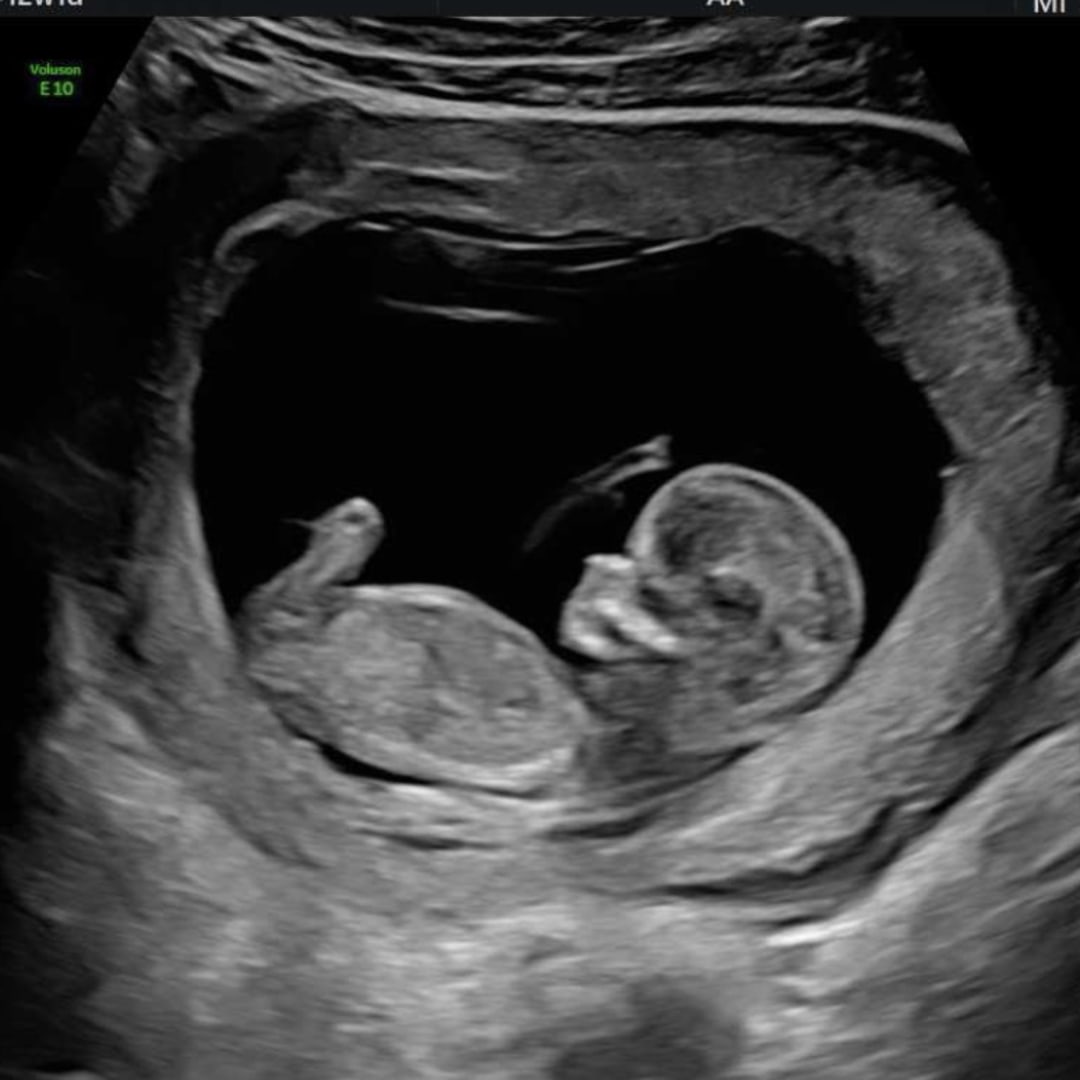 Photo shared by Jennifer for their Babylist baby registry.