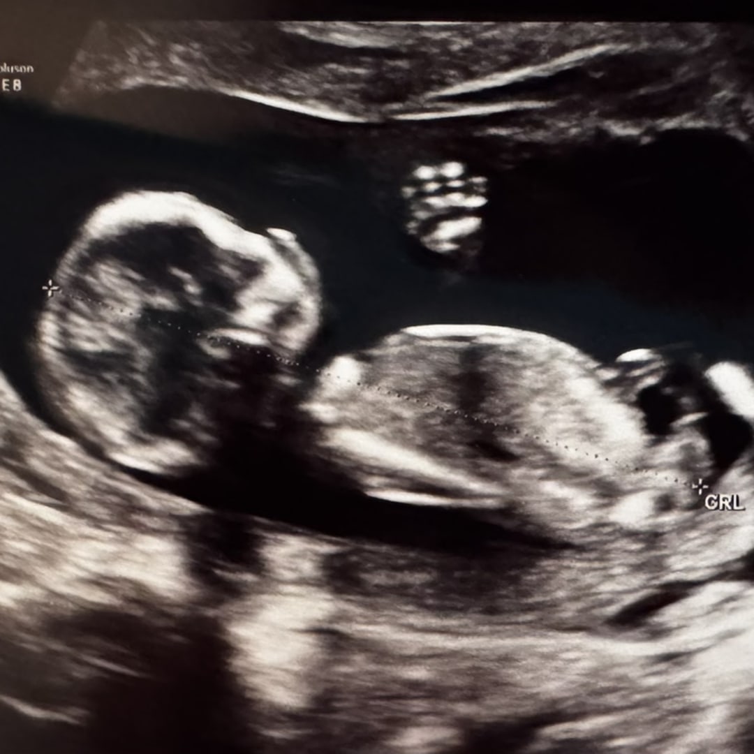 Photo shared by Kasey for their Babylist baby registry.