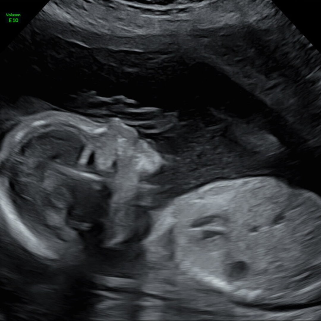 Photo shared by Ava for their Babylist baby registry.