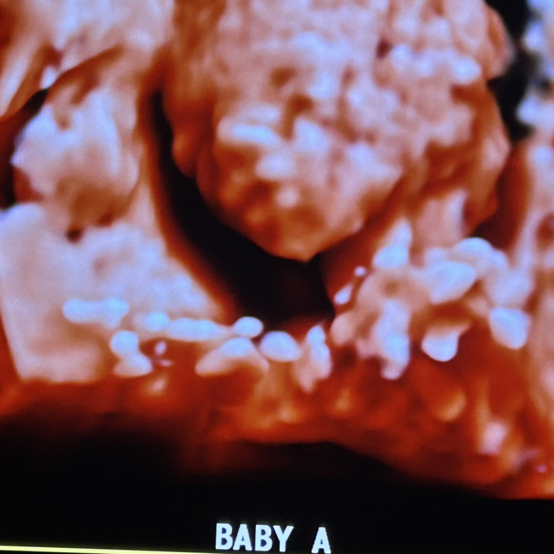 Photo shared by Lileigh for their Babylist baby registry.