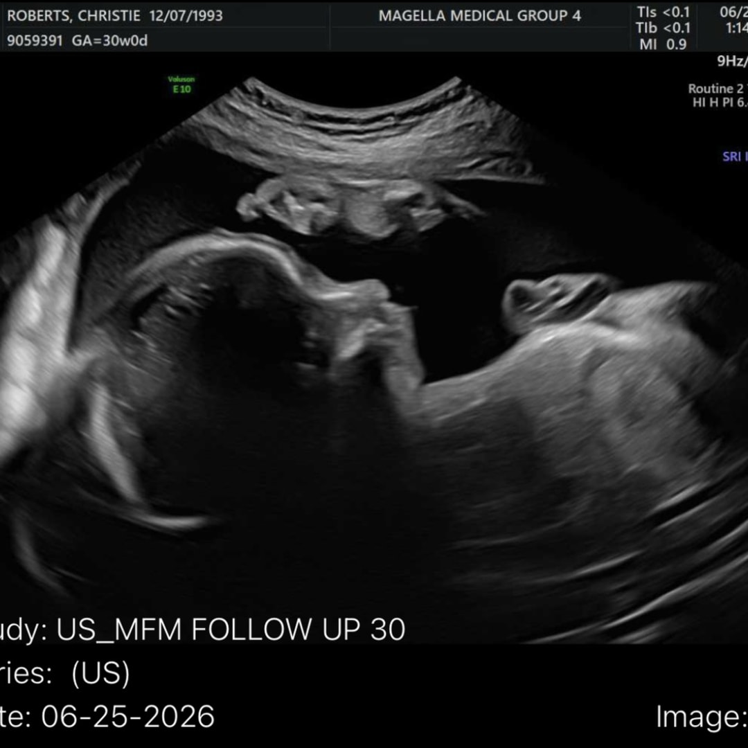 Photo shared by Christie for their Babylist baby registry.