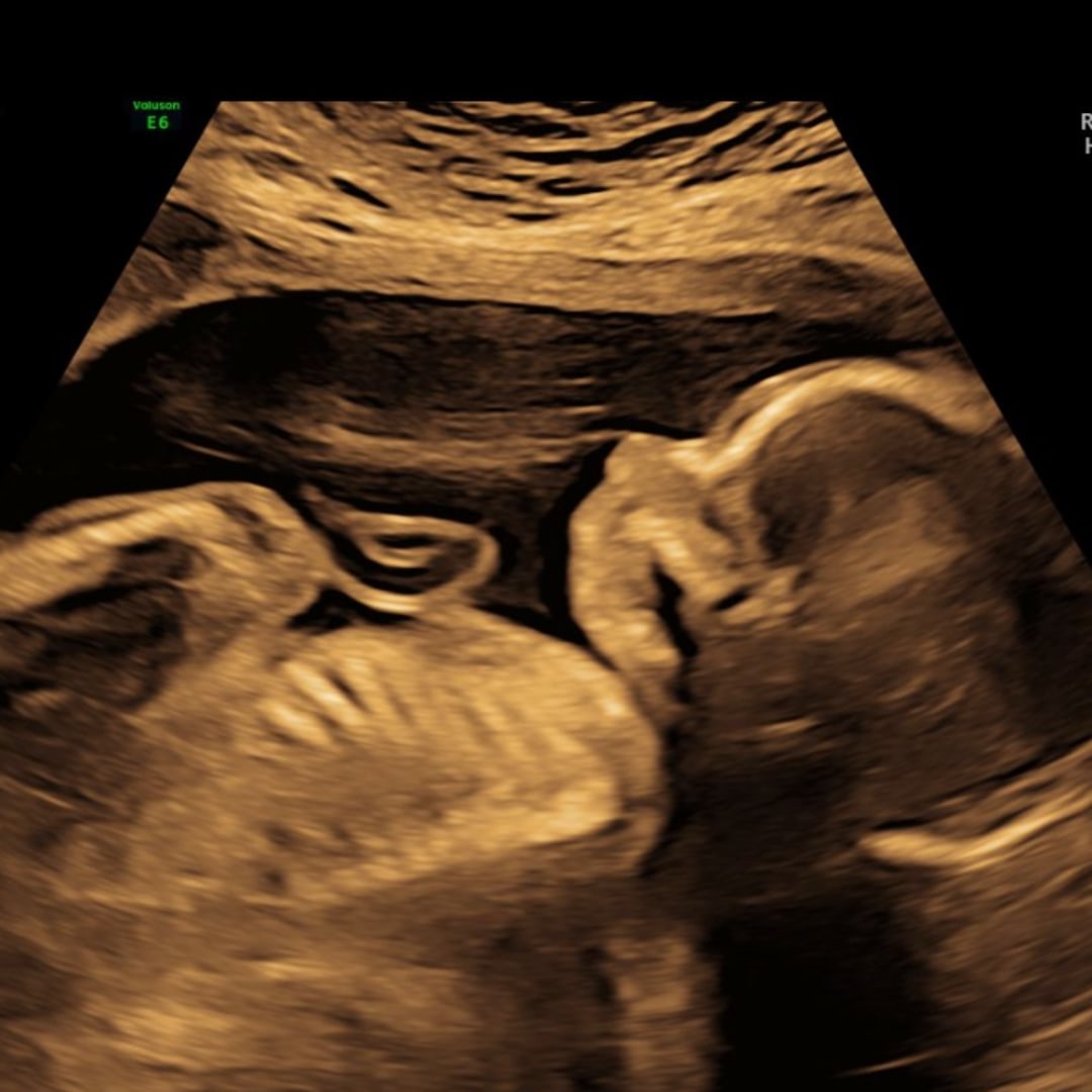 Photo shared by Christina for their Babylist baby registry.