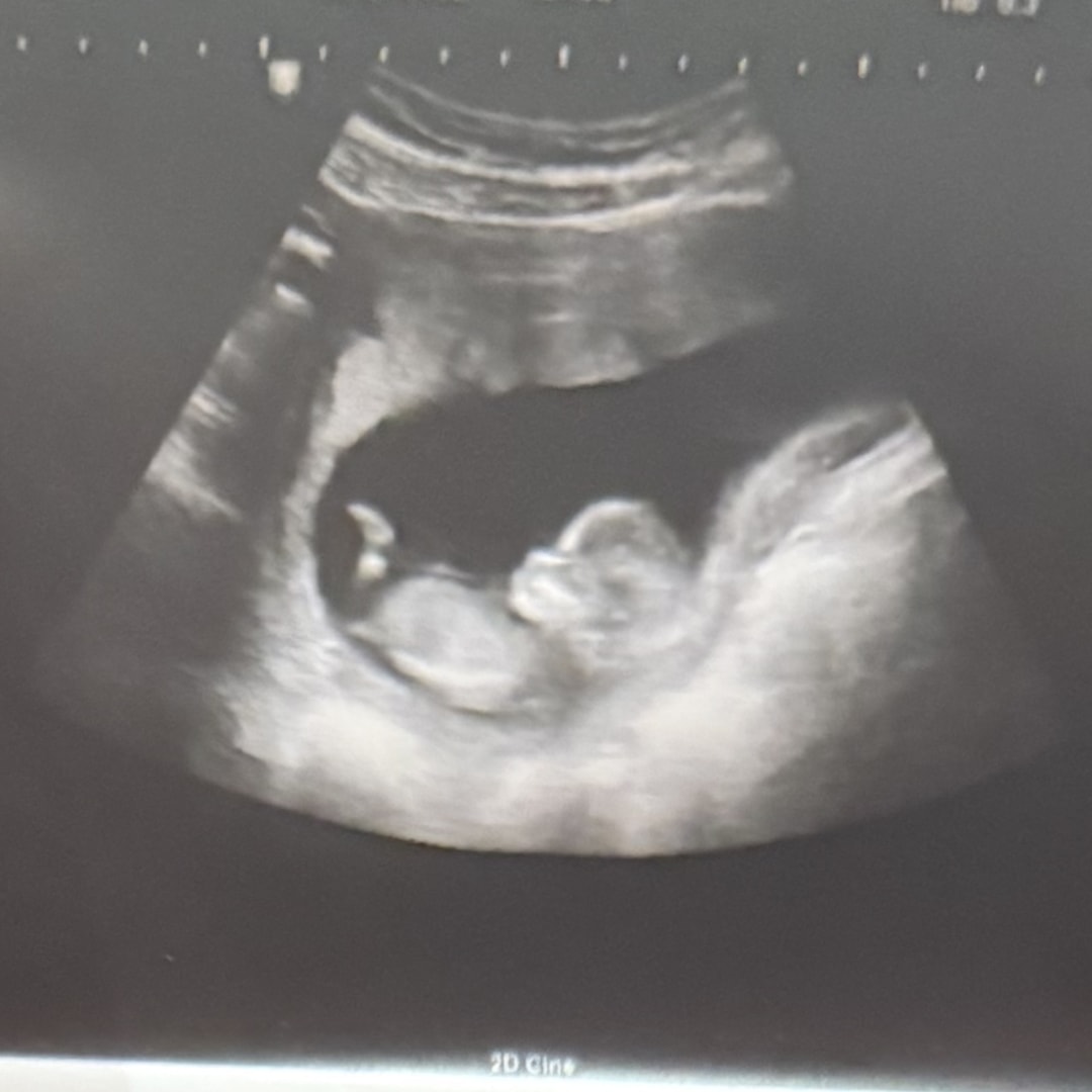 Photo shared by Mecia for their Babylist baby registry.